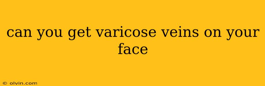 can you get varicose veins on your face